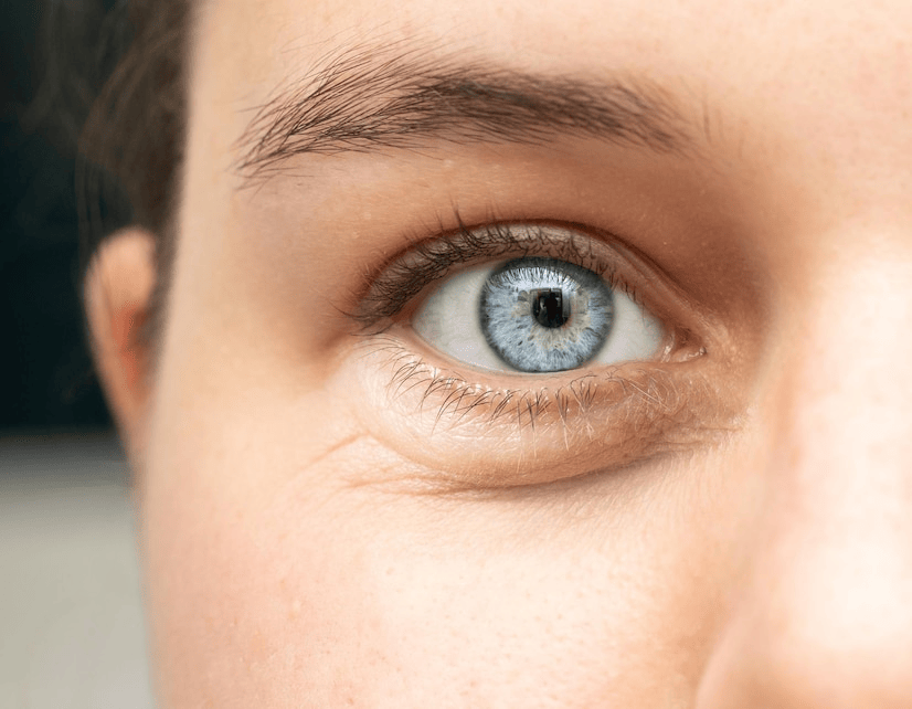 Pasca Operasi Kelopak Mata, Apa Yang Harus Dilakukan