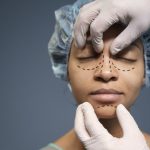 Rhinoplasty Implan atau Tulang Rawan, Mana yang Tepat untuk Kamu