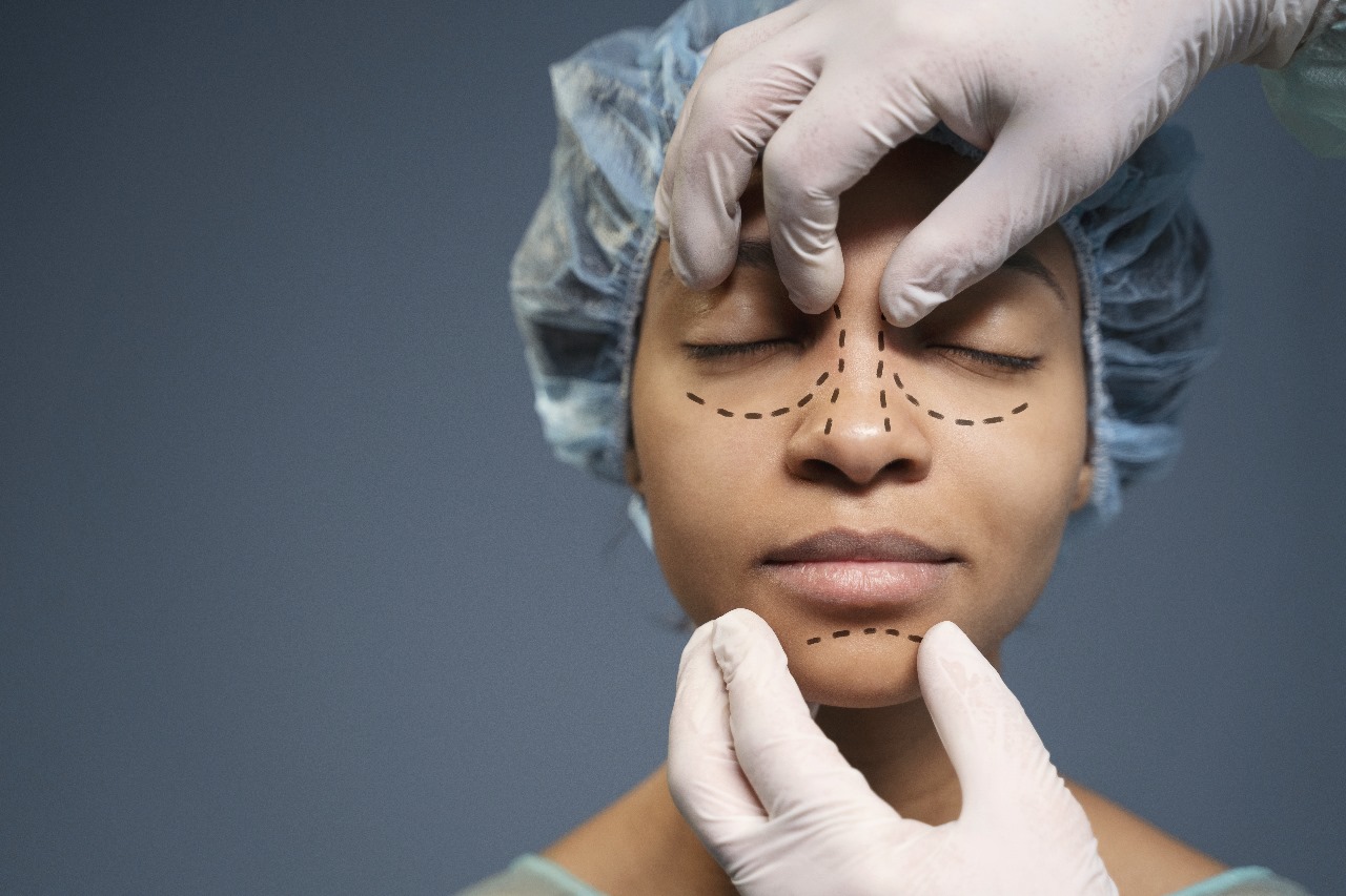 Rhinoplasty Implan atau Tulang Rawan, Mana yang Tepat untuk Kamu